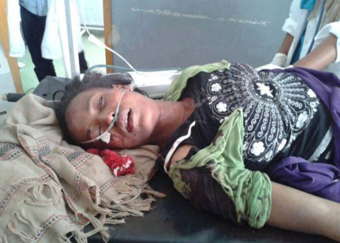Victim of the shooting of the TPLF secuirty forces. Students killed by federal police. የዩኒቨርሲቲ ተማሪዎች ተገደሉ፣ ተደበደቡ